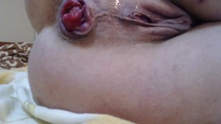 both holes fuck fist and spread on Vacation, pee,speculum and put pee in pussy and ass,show in